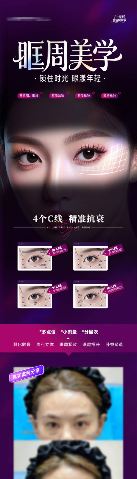 源文件下载【享设计】搜索编号：83330033835884074【医美眼眶眼周抗衰美学案例对比创意海报】