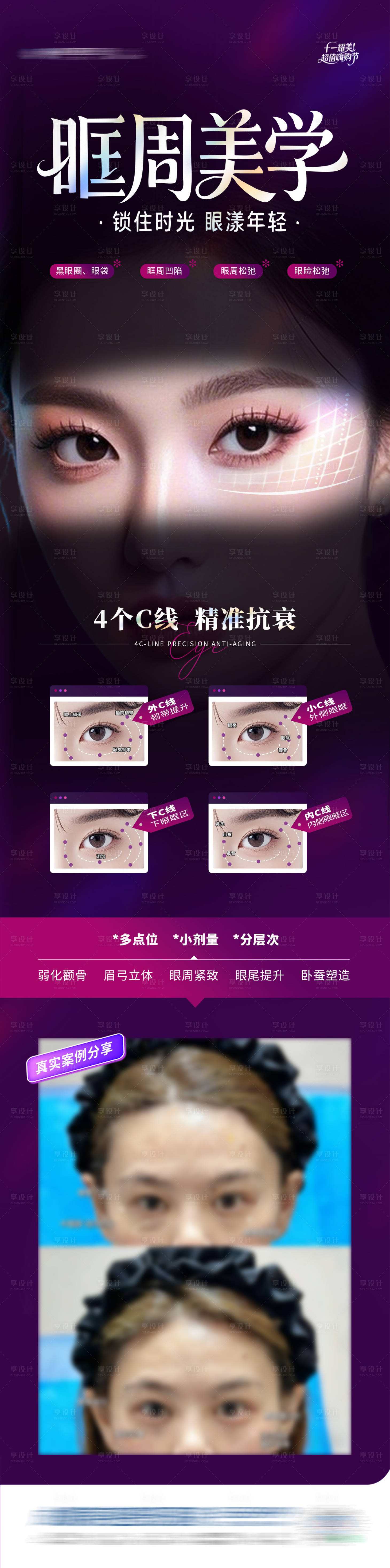 源文件下载【享设计】搜索编号：83330033835884074【医美眼眶眼周抗衰美学案例对比创意海报】