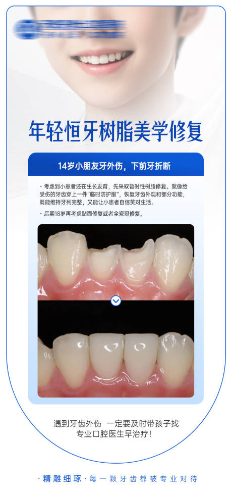源文件下载【享设计】搜索编号：76880033950583730【年轻恒牙树脂美学修复海报】
