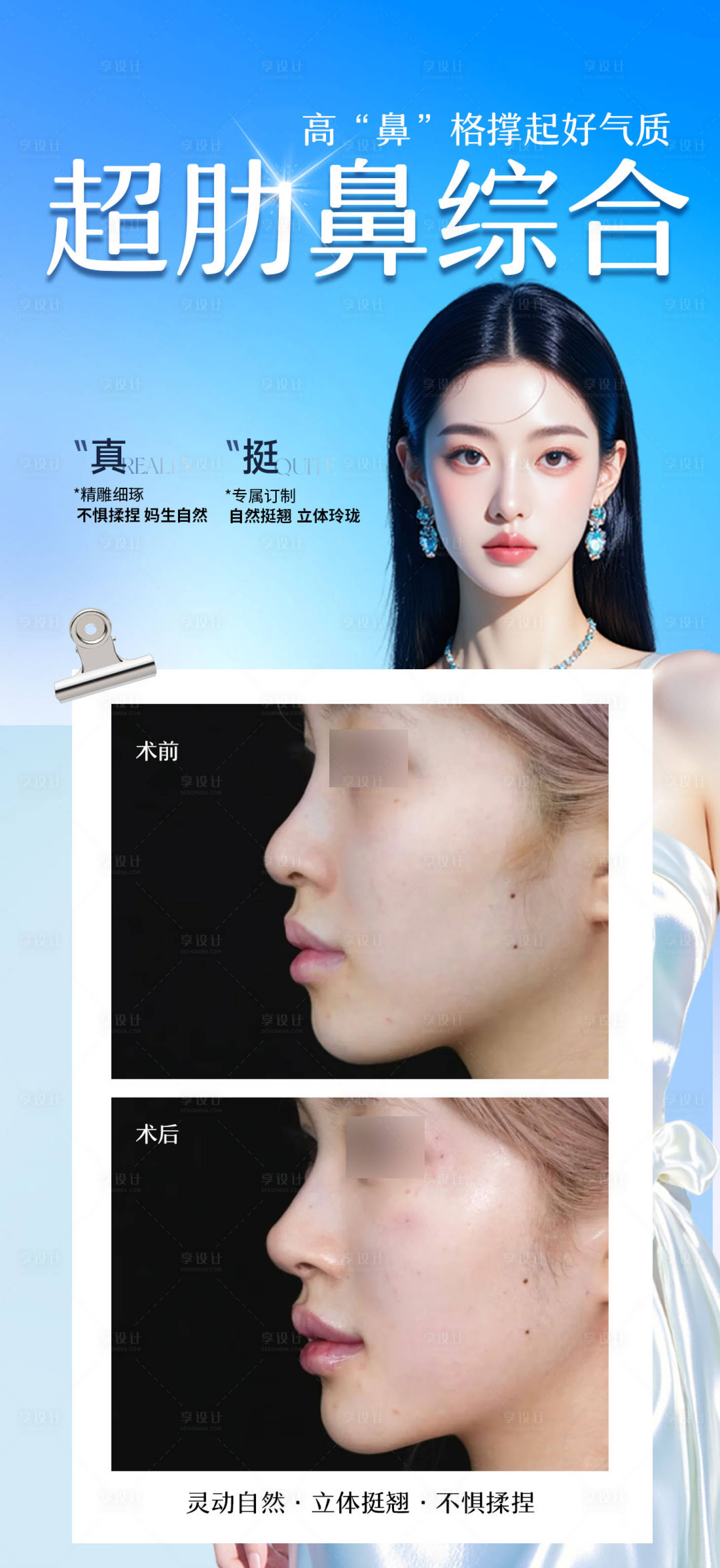 源文件下载【享设计】搜索编号：18850034071422799【医美超肋鼻综合海报】