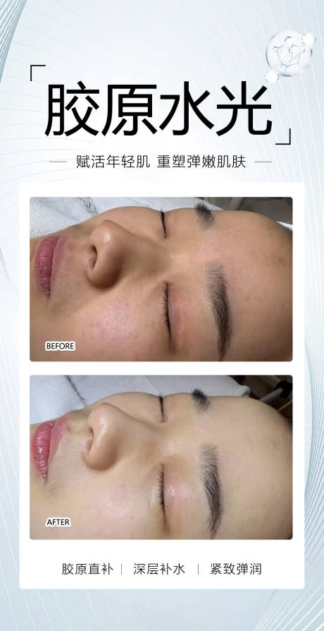 源文件下载【享设计】搜索编号：21910034198562358【胶原水光案例】