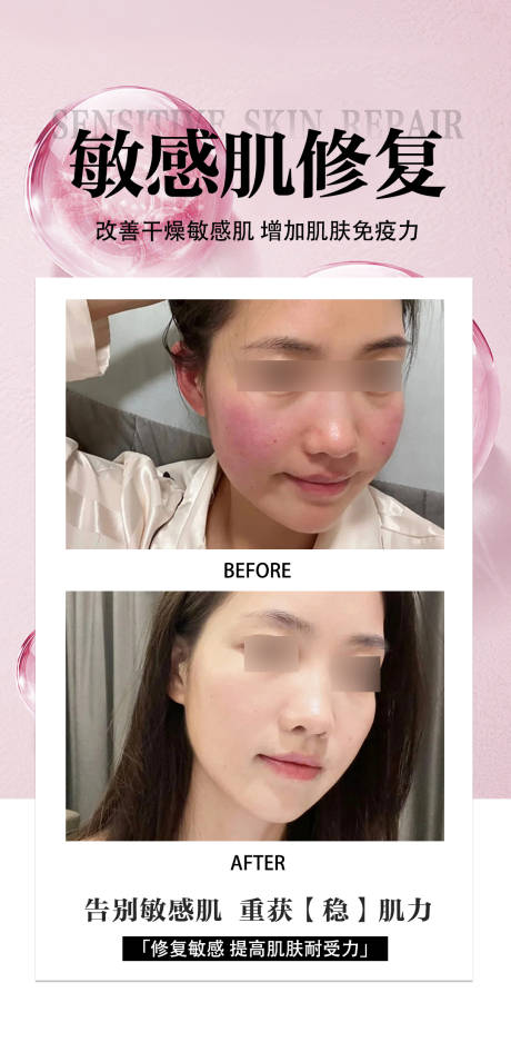 源文件下载【享设计】搜索编号：31930034101395601【敏感肌修复海报】