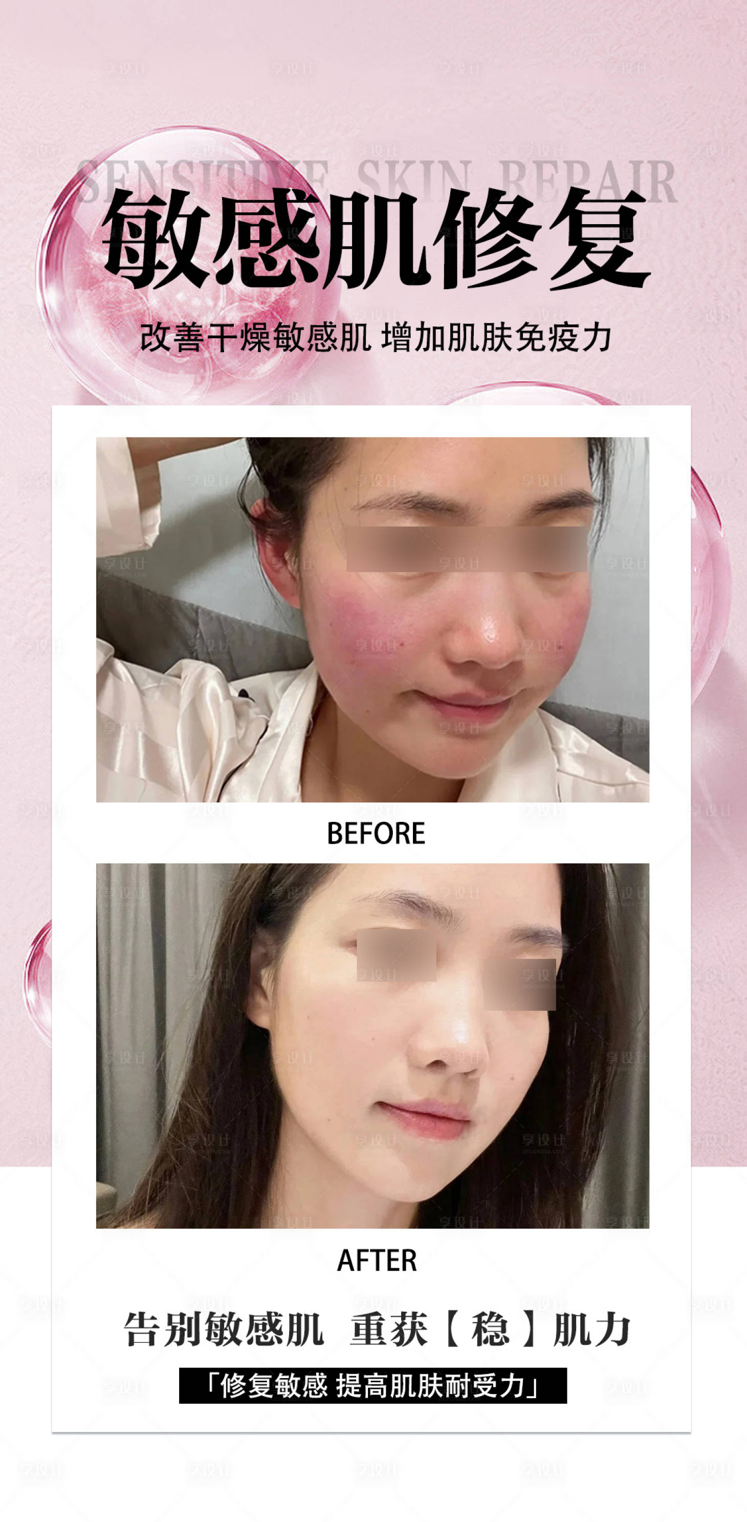 源文件下载【享设计】搜索编号：31930034101395601【敏感肌修复海报】