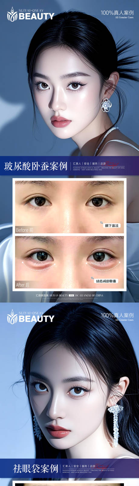 源文件下载【享设计】搜索编号：79370034005342301【医美案例】