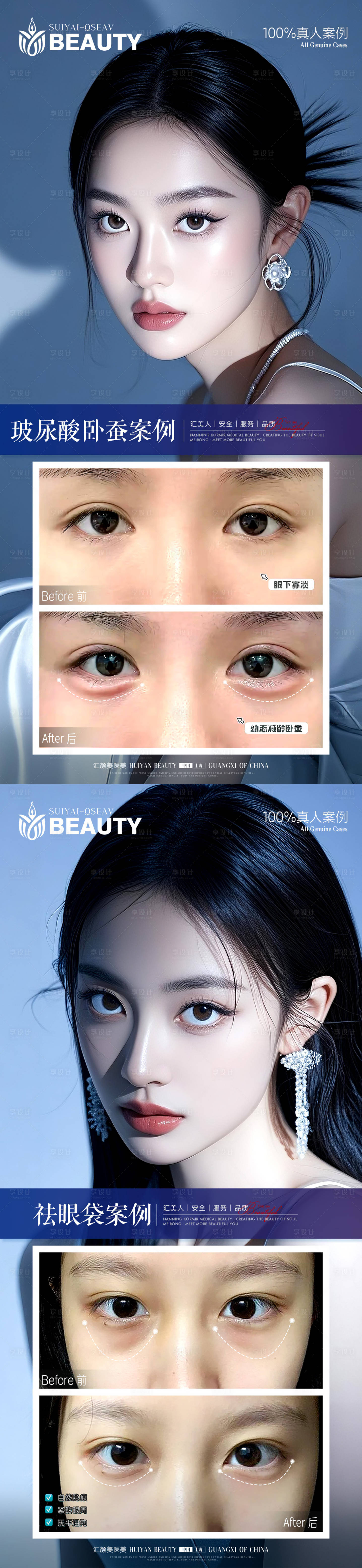 源文件下载【享设计】搜索编号：79370034005342301【医美案例】