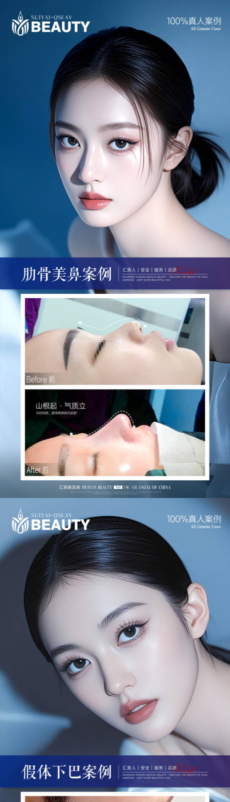 源文件下载【享设计】搜索编号：10670033963333264【医美案例】
