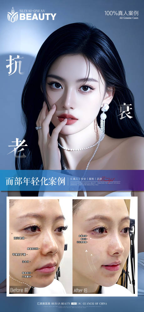 源文件下载【享设计】搜索编号：16880034147163504【面部抗衰案例】