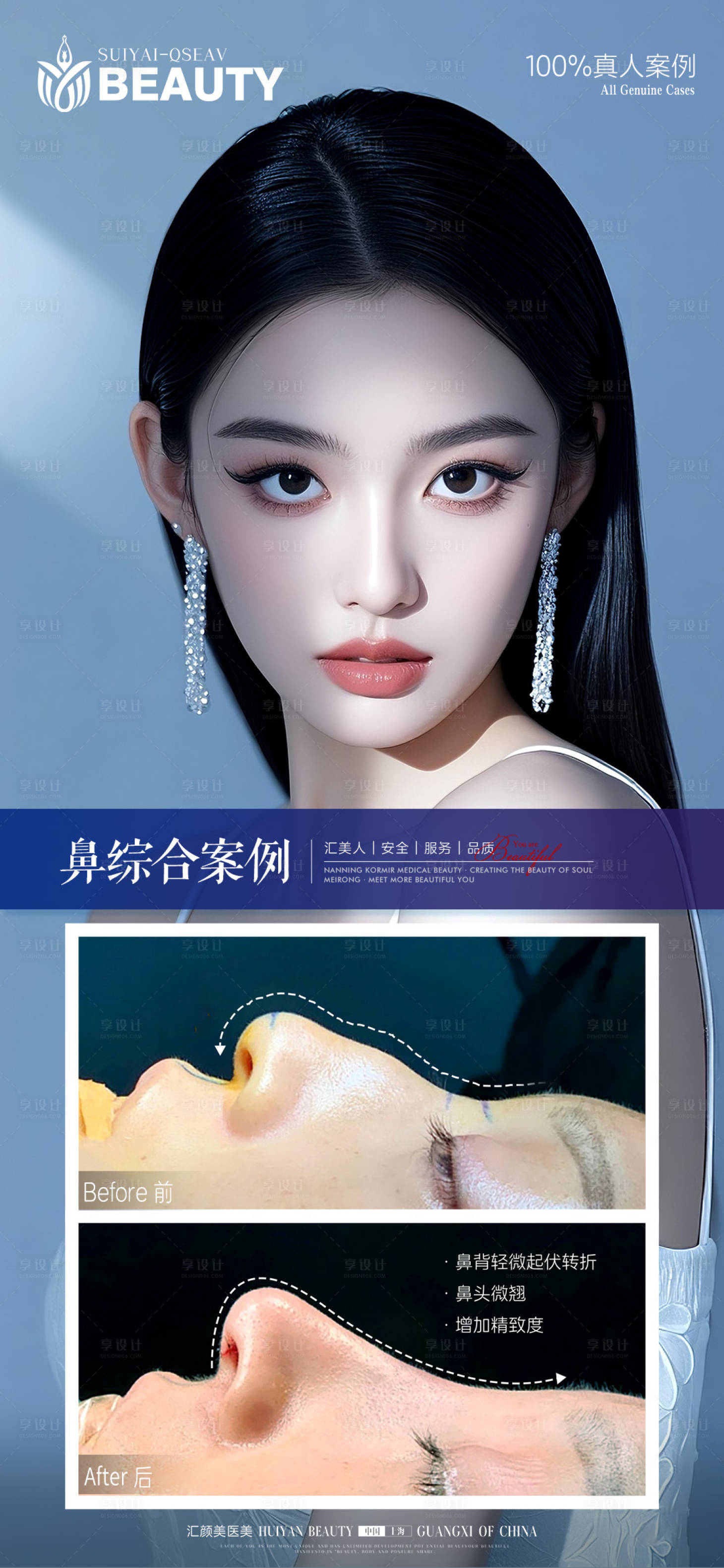 源文件下载【享设计】搜索编号：23490034045168822【医美鼻综合案例海报】