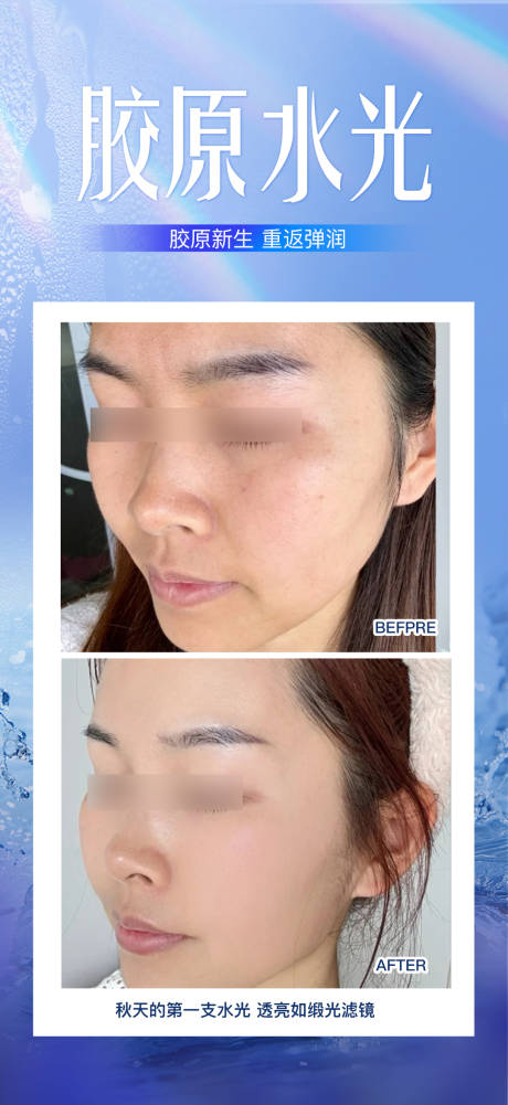 源文件下载【享设计】搜索编号：30760033821535111【胶原水光】