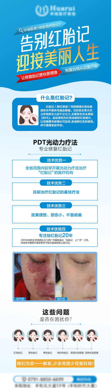 源文件下载【享设计】搜索编号：98520034119626769【医美整形去胎记海报】