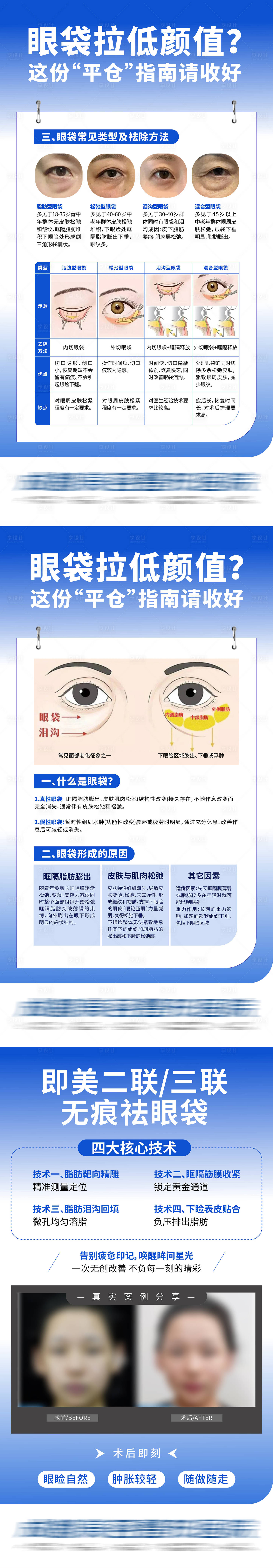 源文件下载【享设计】搜索编号：75060034255591438【医美无创眼袋科普案例系列公众号海报】