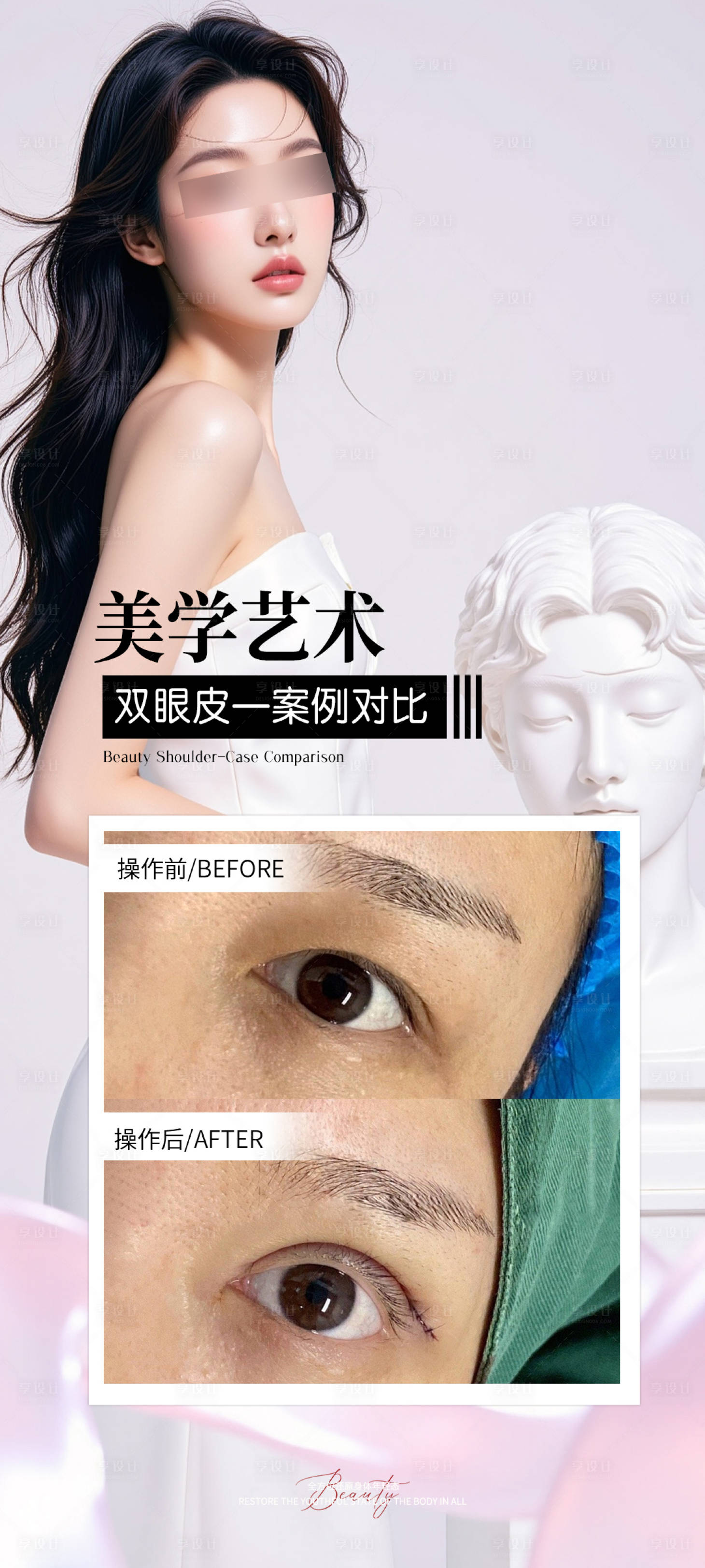 源文件下载【享设计】搜索编号：55000034279103107【双眼皮打造案例海报】