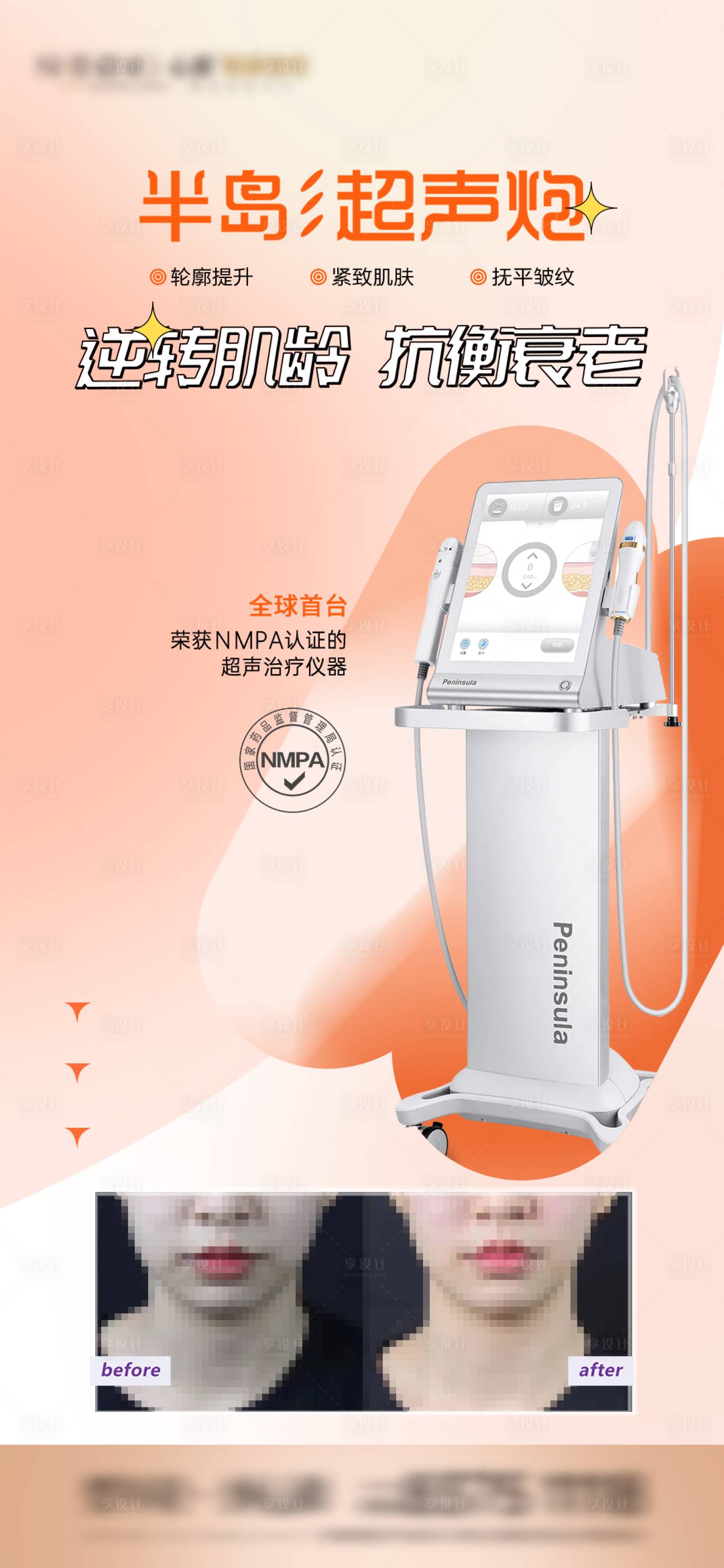 源文件下载【享设计】搜索编号：41800034095397875【超声炮案例】