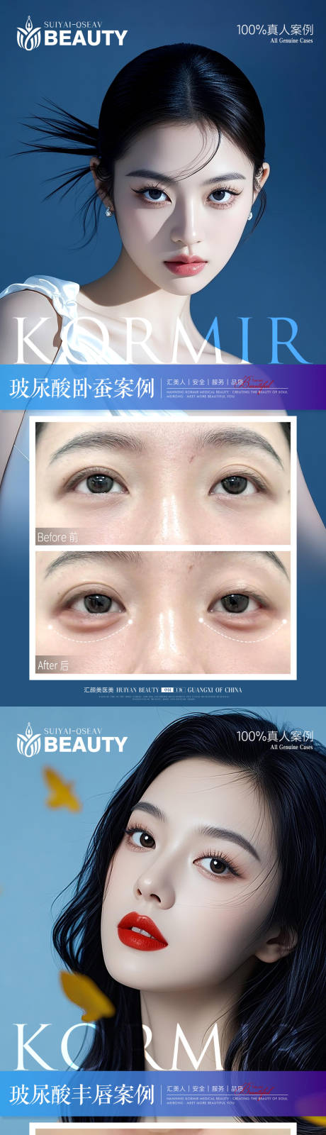 源文件下载【享设计】搜索编号：77460034147186652【医美案例】