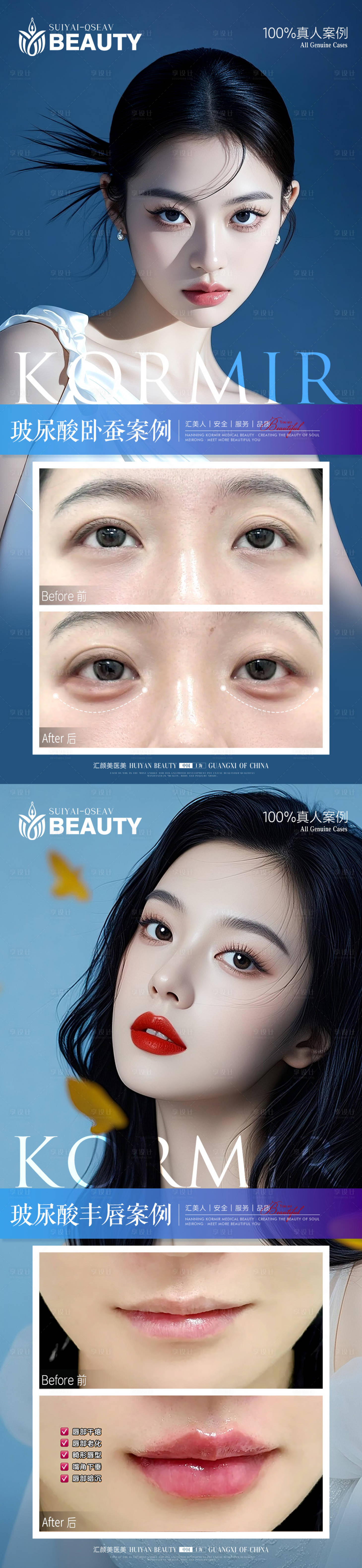 源文件下载【享设计】搜索编号：77460034147186652【医美案例】