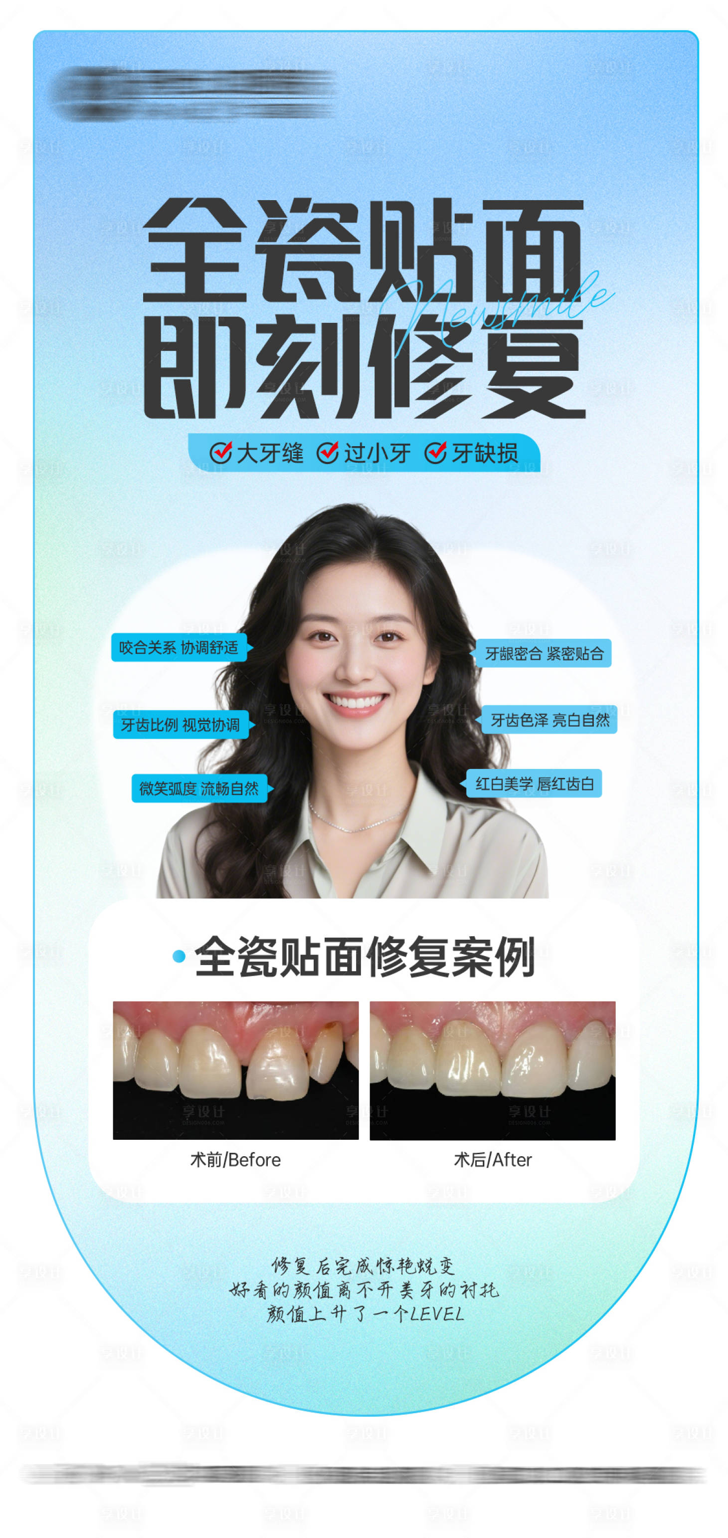 源文件下载【享设计】搜索编号：46460034276422990【全瓷贴面案例海报】