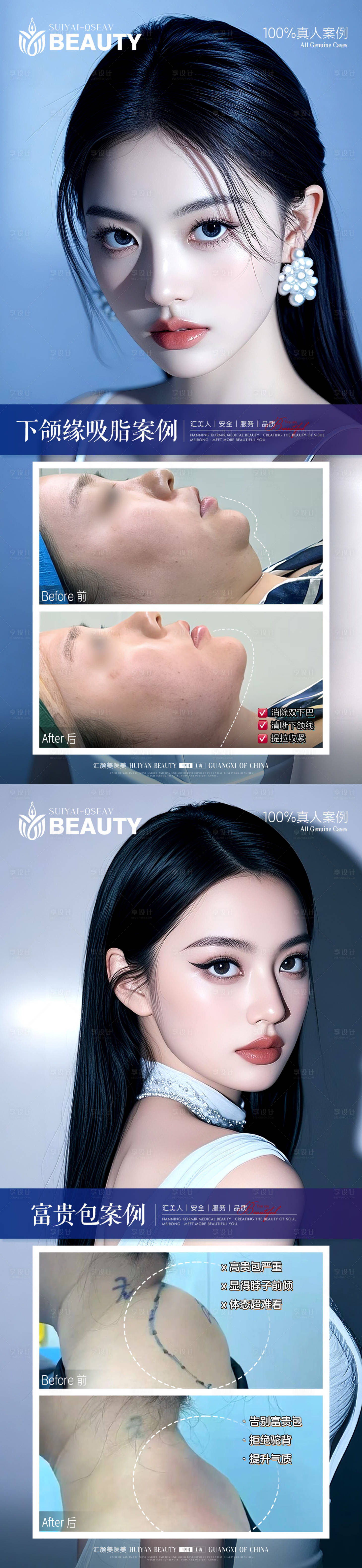 源文件下载【享设计】搜索编号：11250034047696590【医美案例】