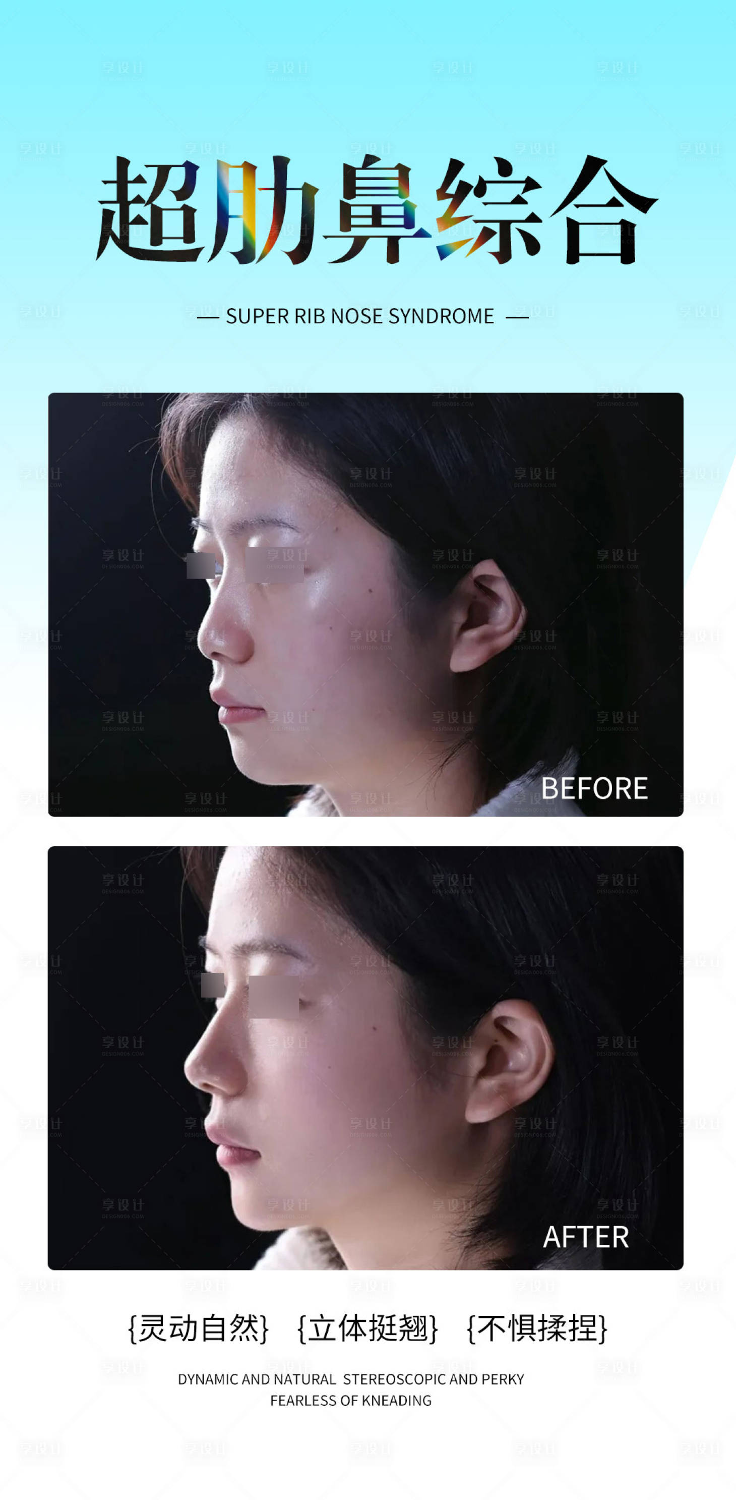 源文件下载【享设计】搜索编号：78700033835264985【超肋骨鼻综合】