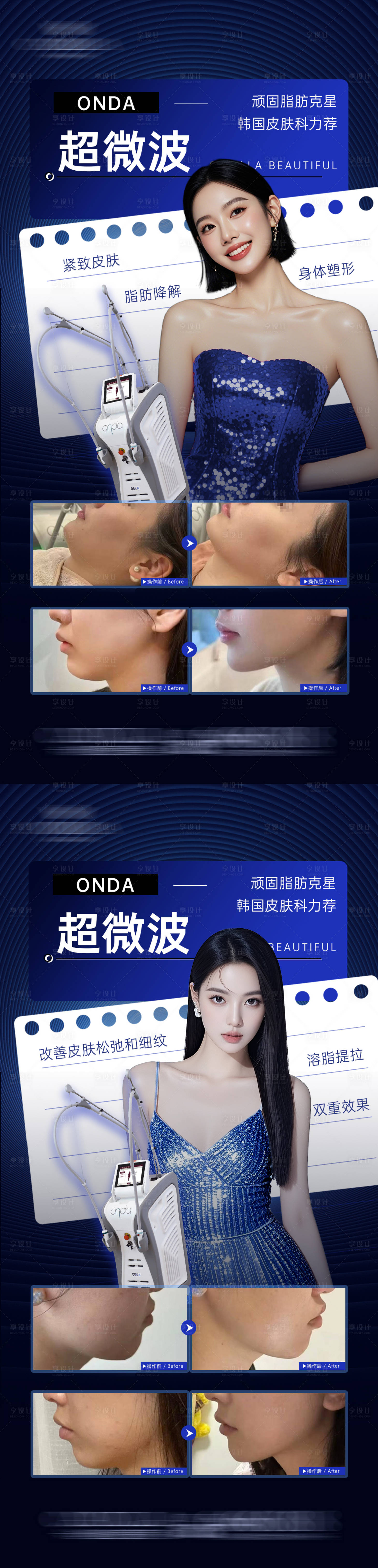 源文件下载【享设计】搜索编号：88520034041862117【医美吸脂塑形案例海报】