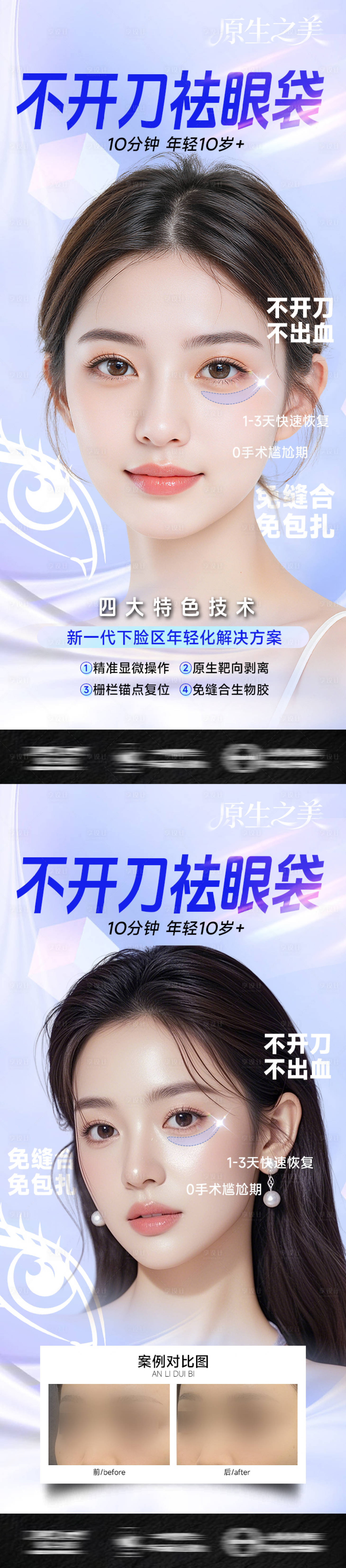源文件下载【享设计】搜索编号：93070033853412958【医美眼整形海报-不开刀祛眼袋】