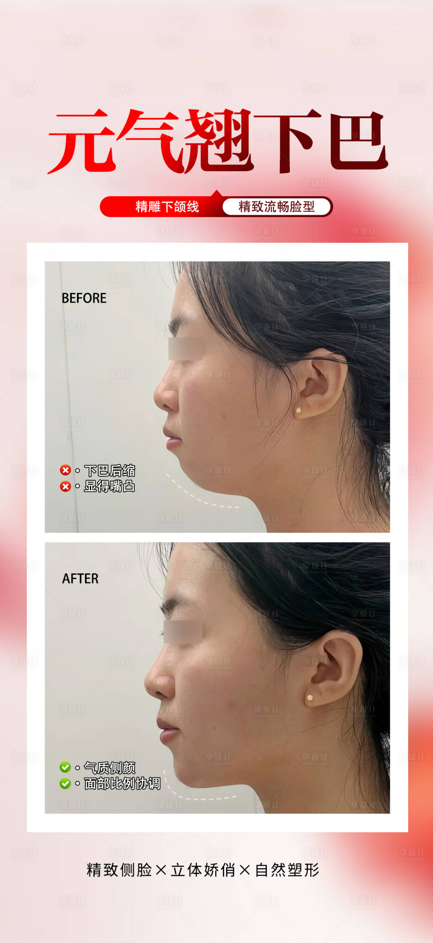 源文件下载【享设计】搜索编号：26970034101334438【元气翘下巴海报】