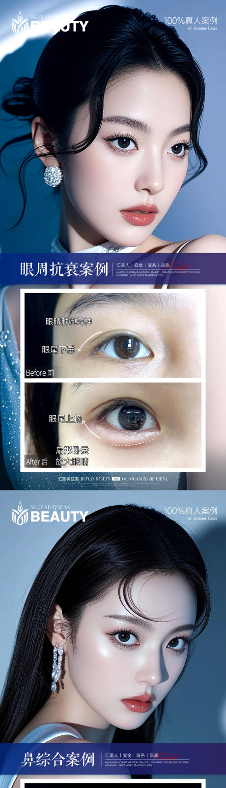 源文件下载【享设计】搜索编号：63120034001447516【鼻综合眼周抗衰案例】