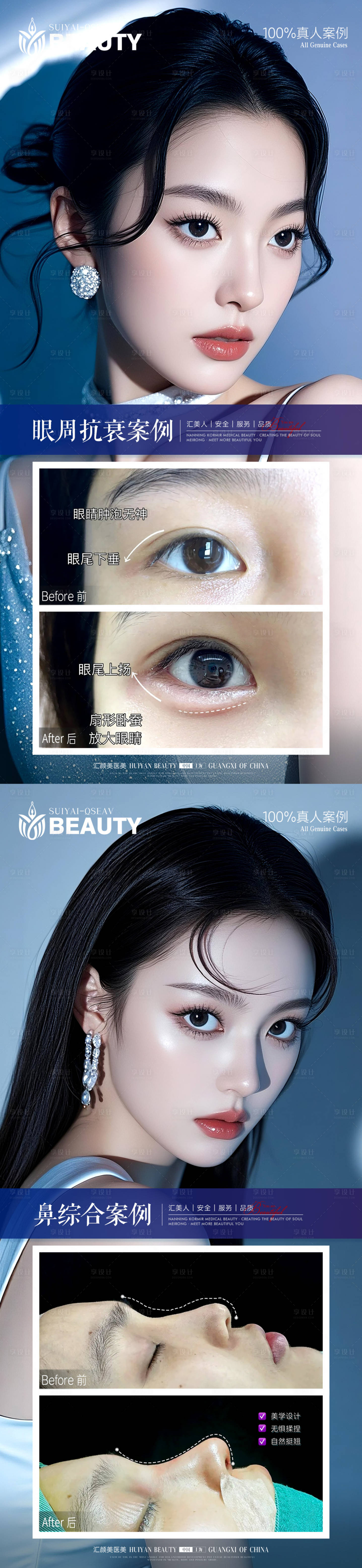 源文件下载【享设计】搜索编号：63120034001447516【鼻综合眼周抗衰案例】