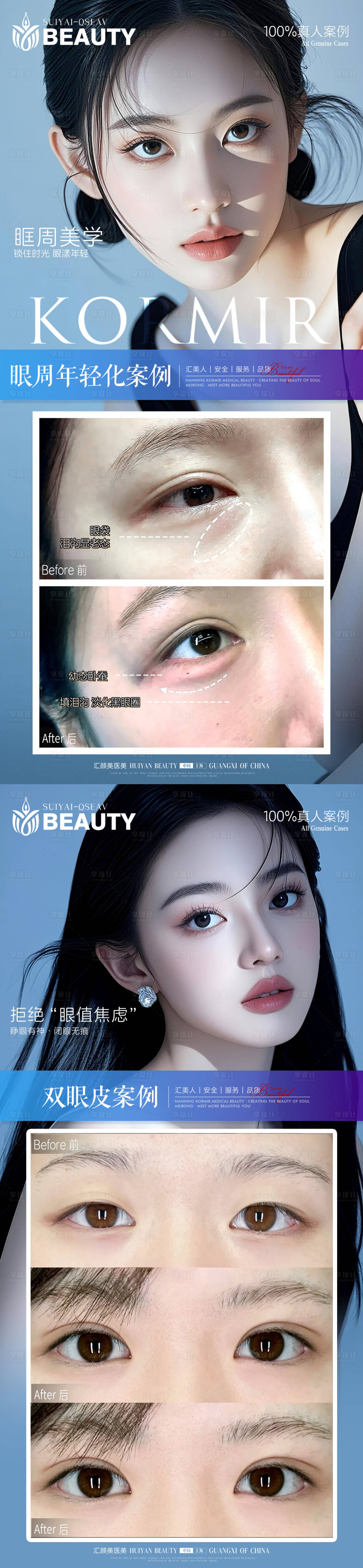 源文件下载【享设计】搜索编号：80170034168469738【医美案例】