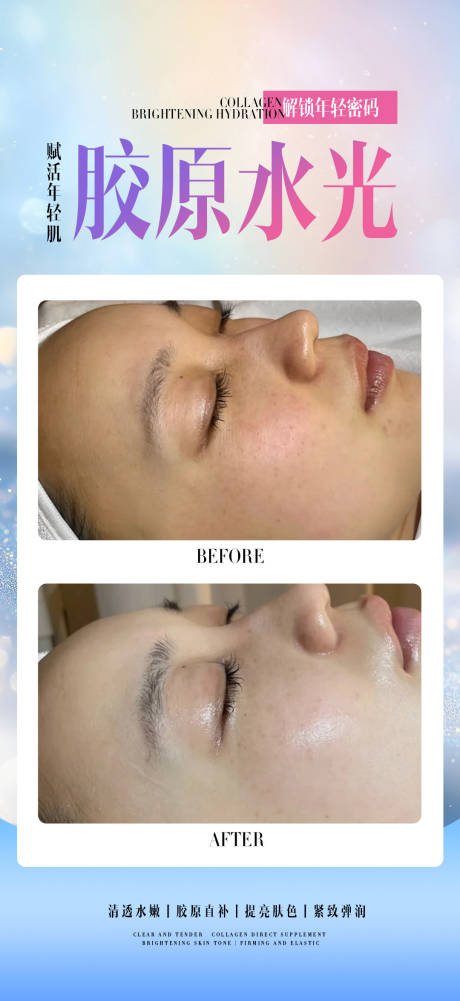 源文件下载【享设计】搜索编号：75590034071364036【胶原水光】