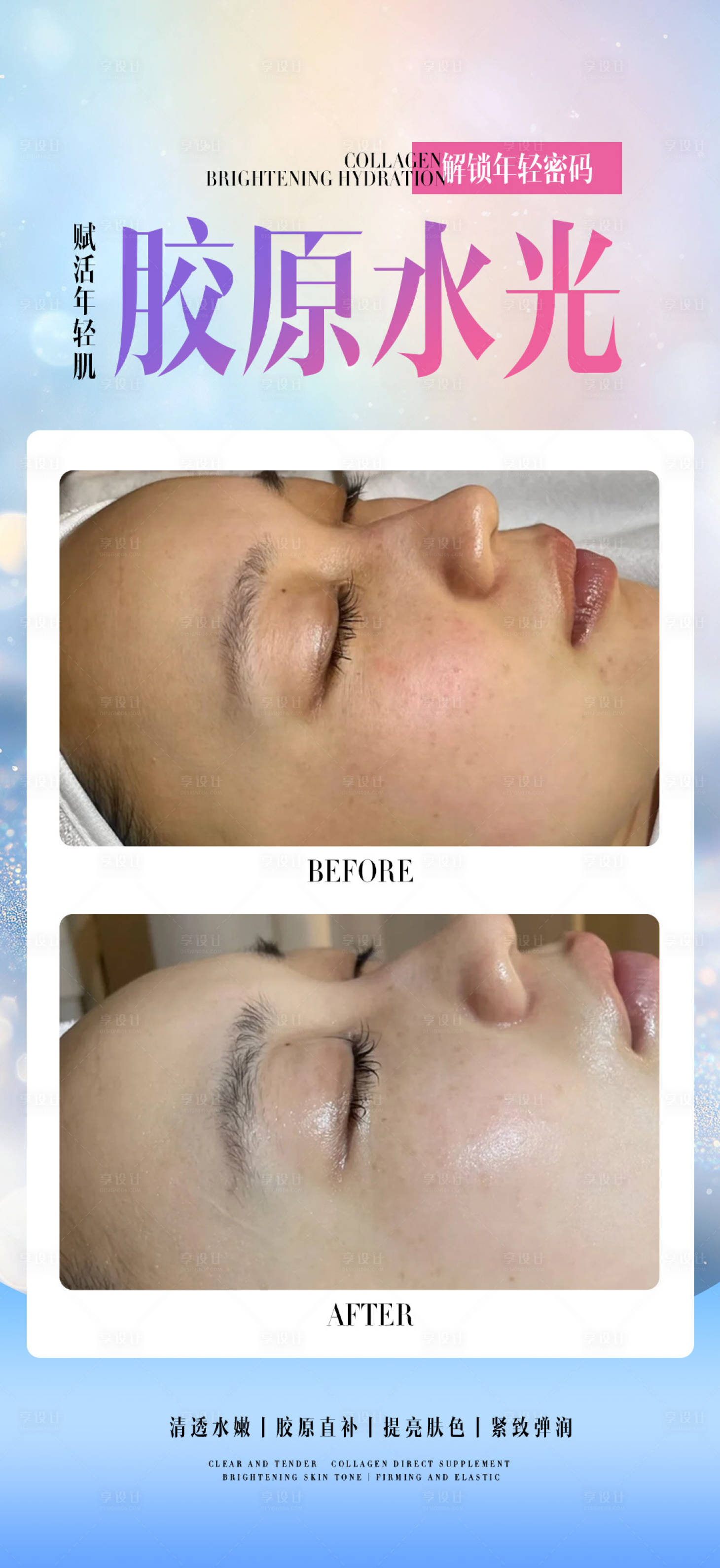 源文件下载【享设计】搜索编号：75590034071364036【胶原水光】