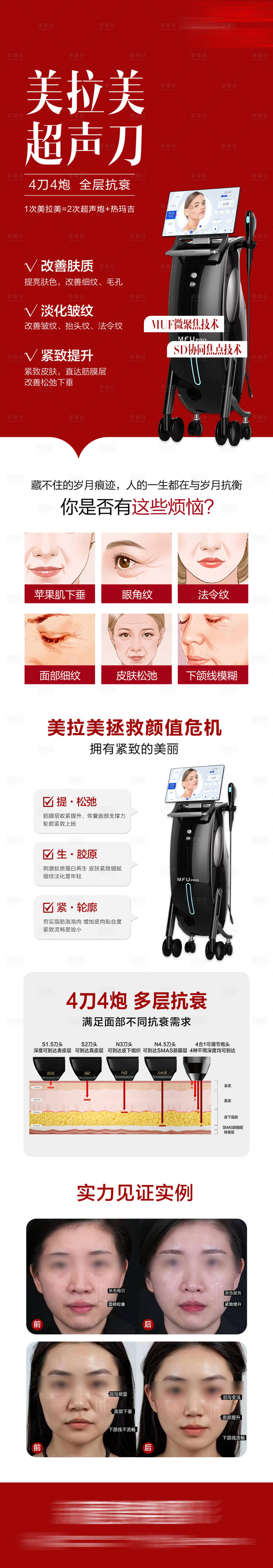 源文件下载【享设计】搜索编号：78260033932163234【医美美拉美超声刀海报长图】