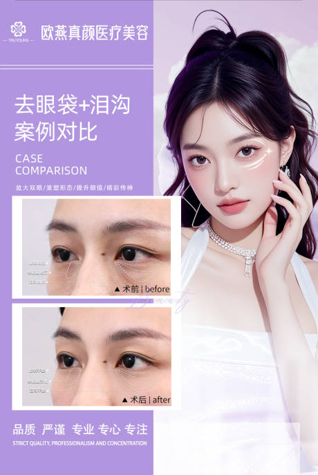 源文件下载【享设计】搜索编号：94490034079172275【医美眼周对比】