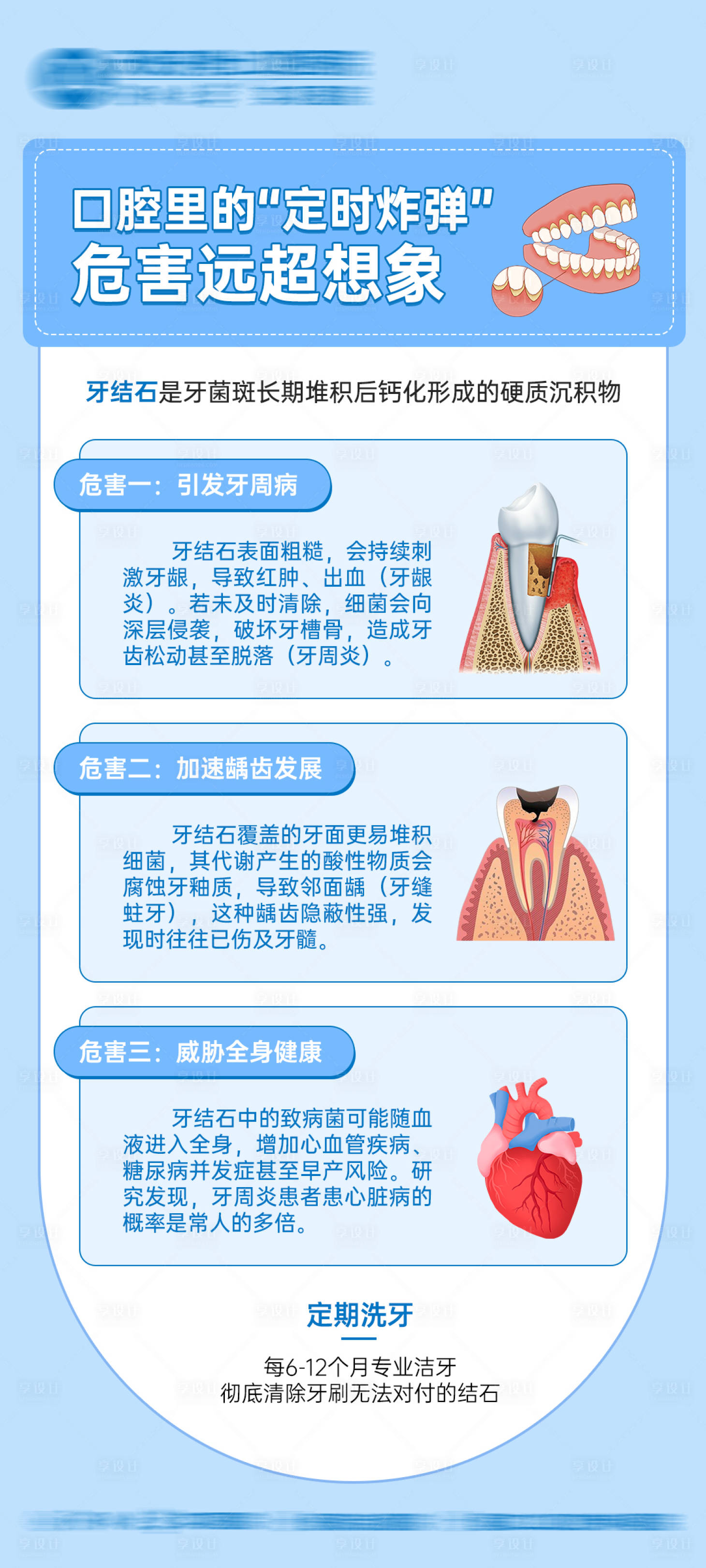 源文件下載【享設計】搜索編號：95180034252941559【牙結石科普宣傳海報】