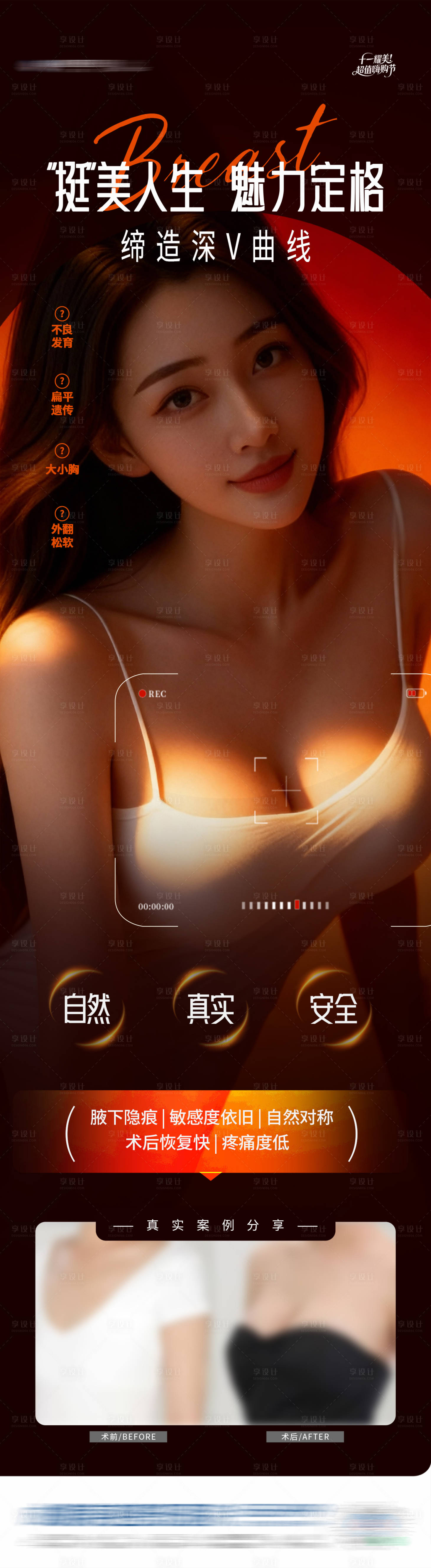 源文件下载【享设计】搜索编号：43120034084258526【医美舒适隆胸丰胸案例创意海报】