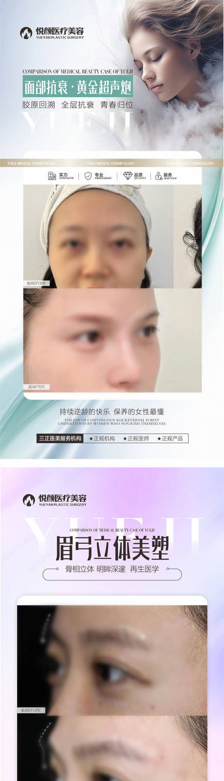 源文件下载【享设计】搜索编号：96030034112922292【医美对比图模板】