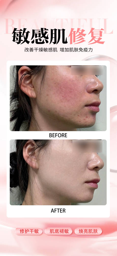 源文件下载【享设计】搜索编号：49760033814172999【敏感肌修复海报】