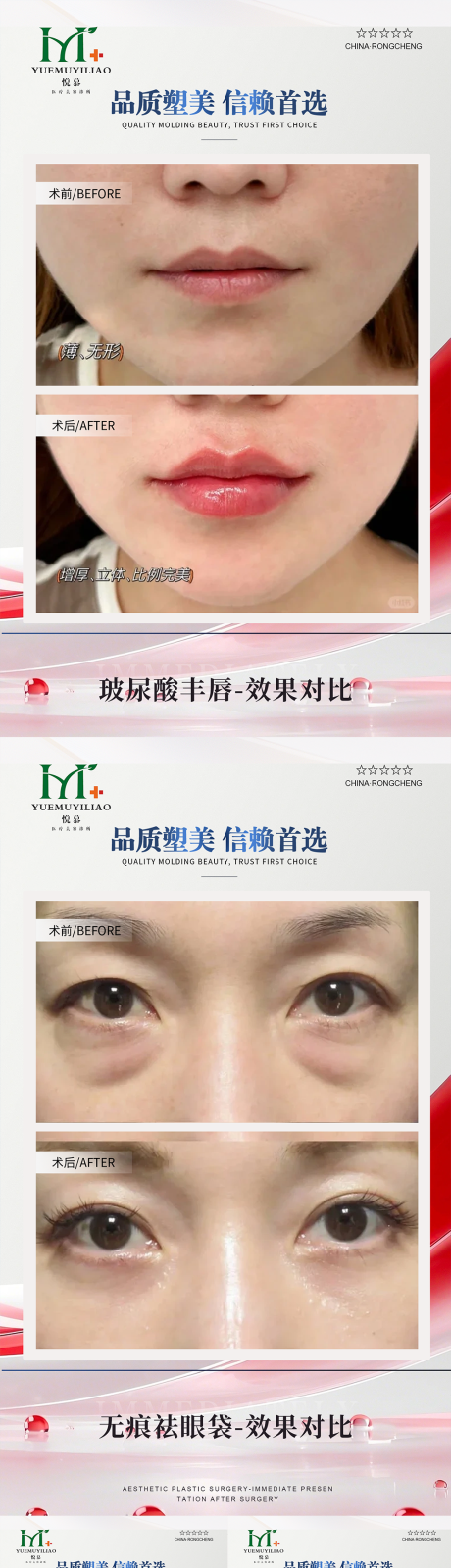 源文件下载【享设计】搜索编号：85990033979352806【医美案例】