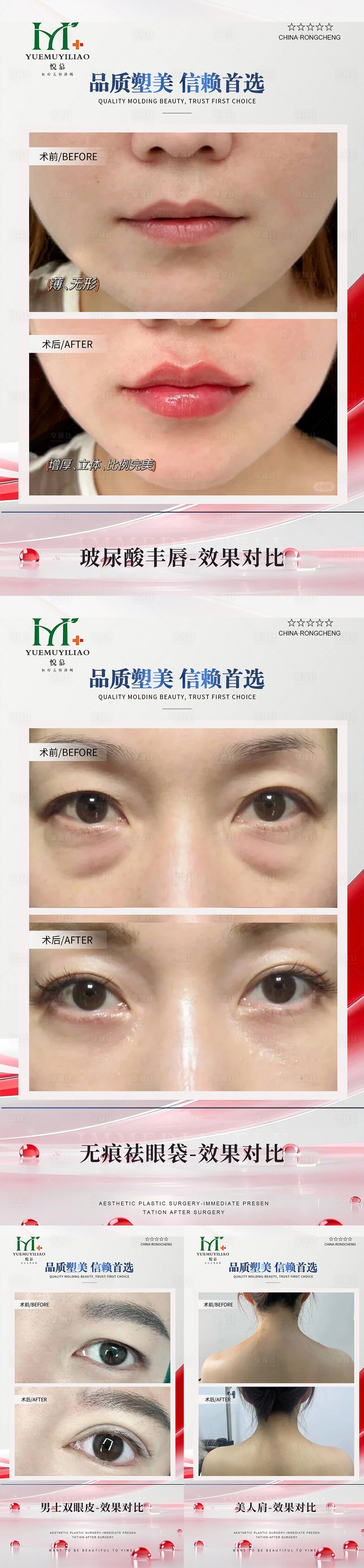 源文件下载【享设计】搜索编号：85990033979352806【医美案例】