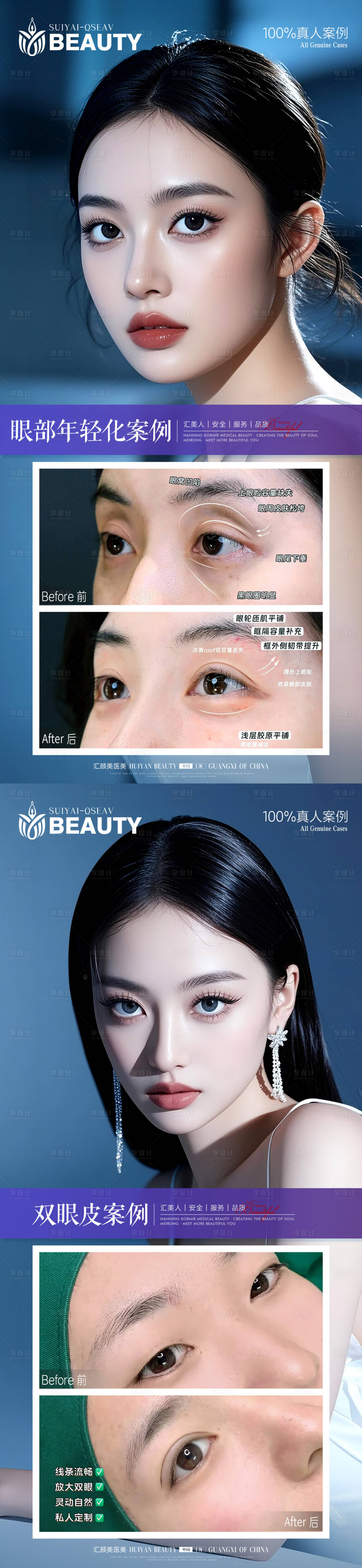 源文件下载【享设计】搜索编号：97350034075077032【医美案例】