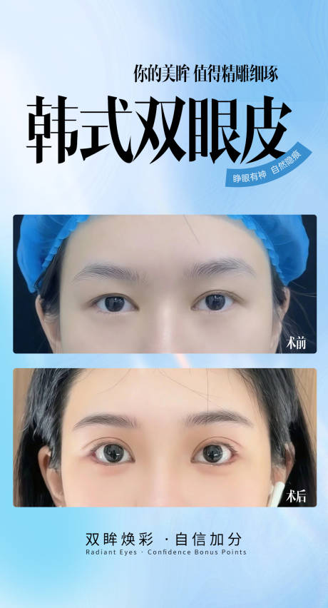 源文件下载【享设计】搜索编号：89010033835193153【韩式双眼皮】