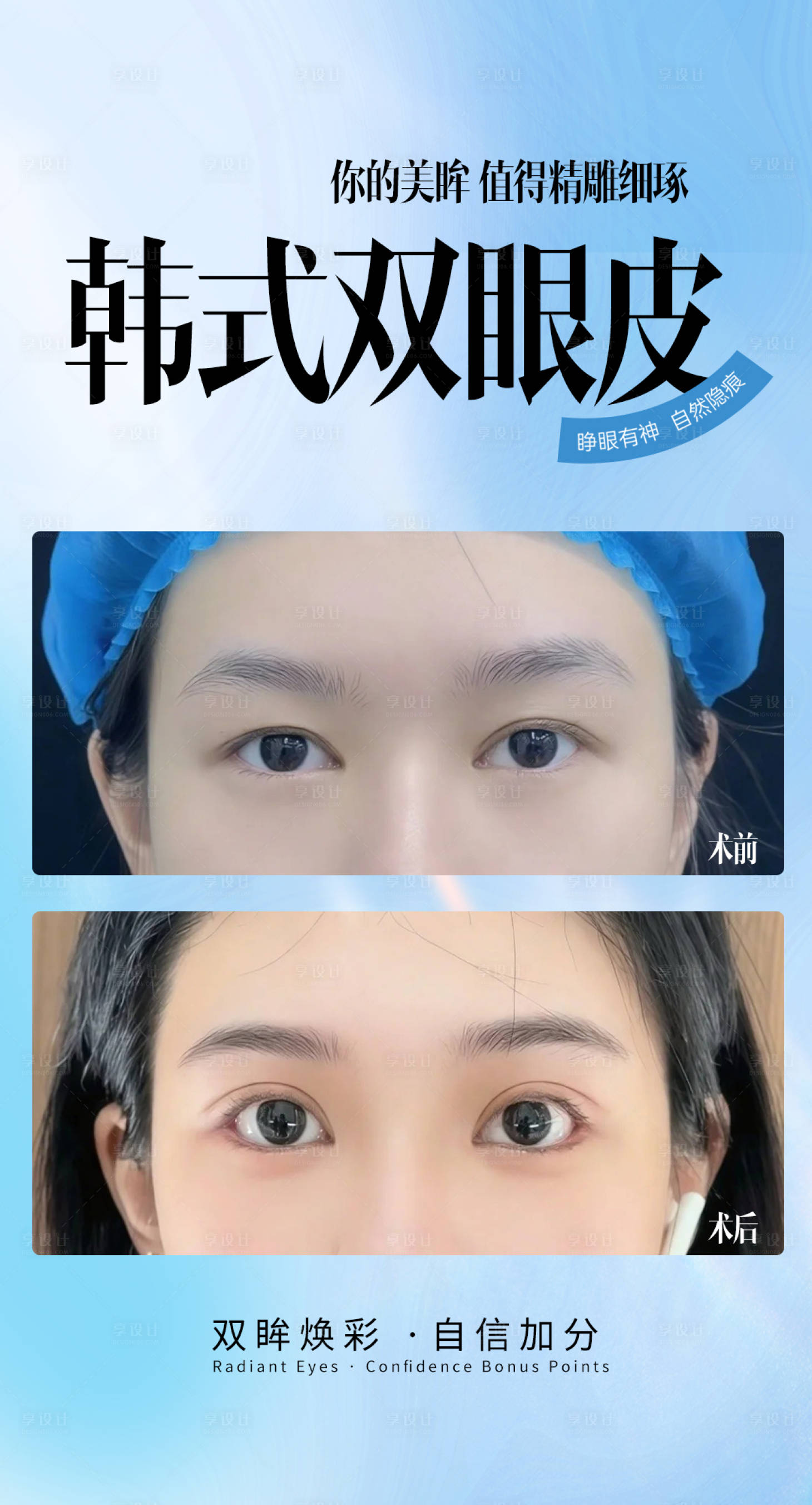 源文件下载【享设计】搜索编号：89010033835193153【韩式双眼皮】