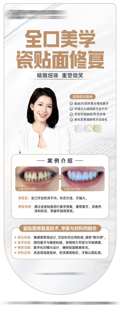 源文件下载【享设计】搜索编号：91950034046819567【瓷贴面案例宣传海报】