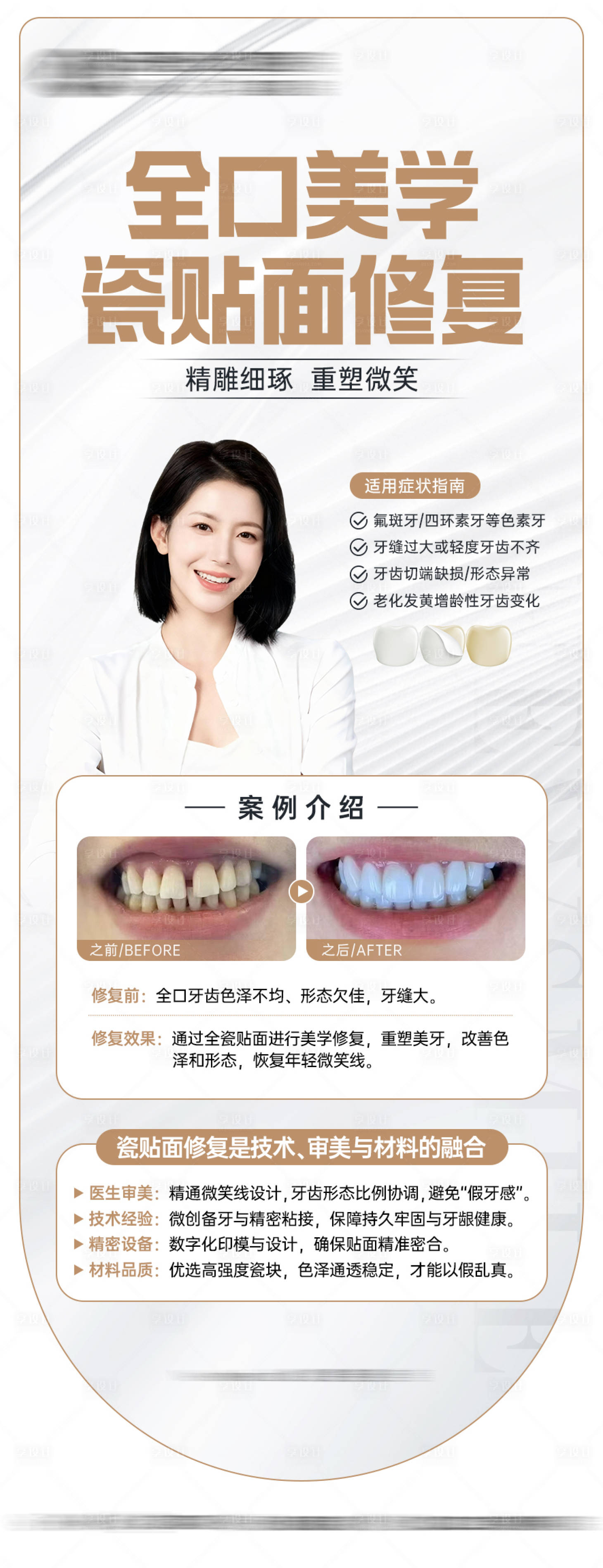 源文件下载【享设计】搜索编号：91950034046819567【瓷贴面案例宣传海报】