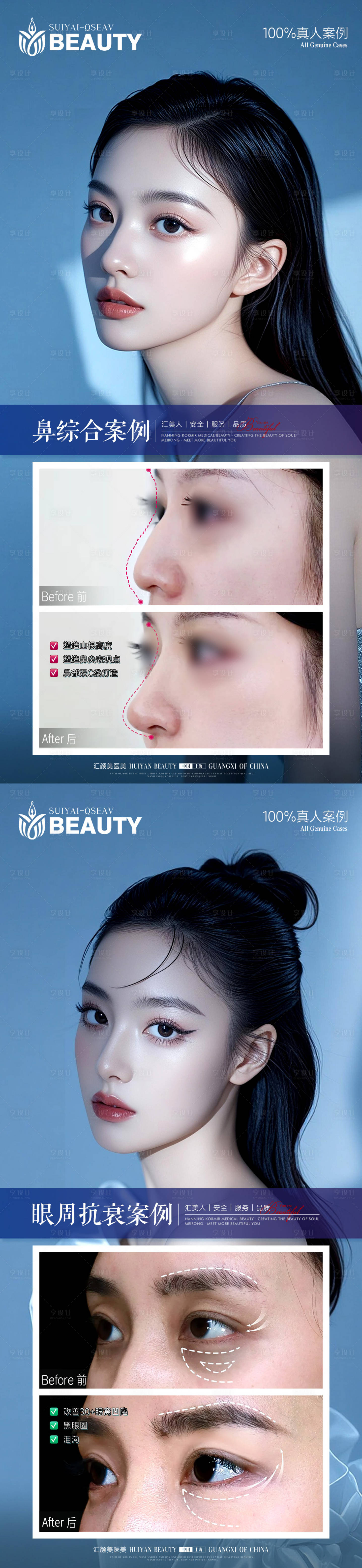 源文件下载【享设计】搜索编号：36920033946629338【医美案例】