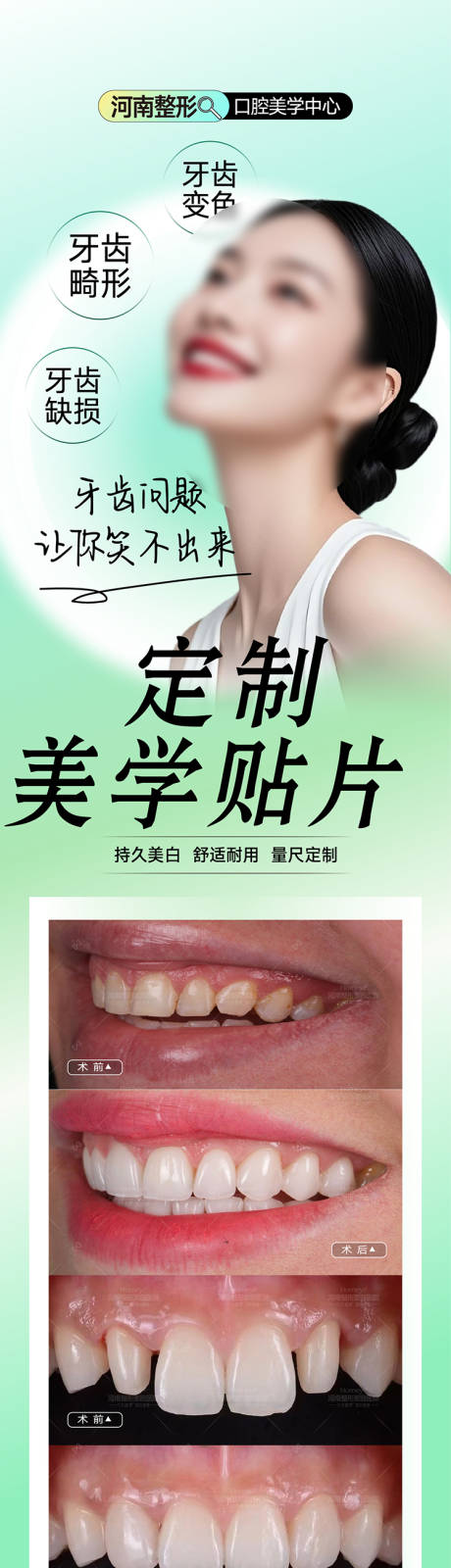 源文件下載【享設計】搜索編號：90160034164726570【牙齒貼片海報  】