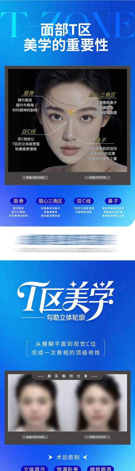 源文件下载【享设计】搜索编号：99470034148382297【面部T区美学公众号】