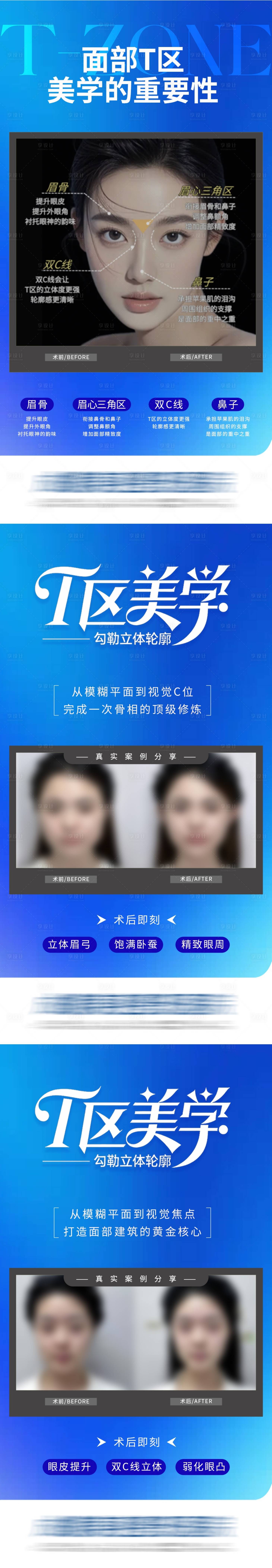 源文件下载【享设计】搜索编号：99470034148382297【面部T区美学公众号】