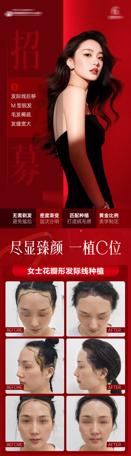 源文件下载【享设计】搜索编号：86910033914188178【植发案例招募】