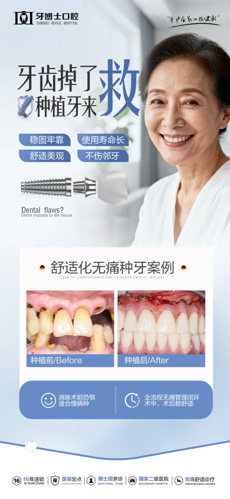 源文件下载【享设计】搜索编号：40550033863943092【种植牙案例海报】