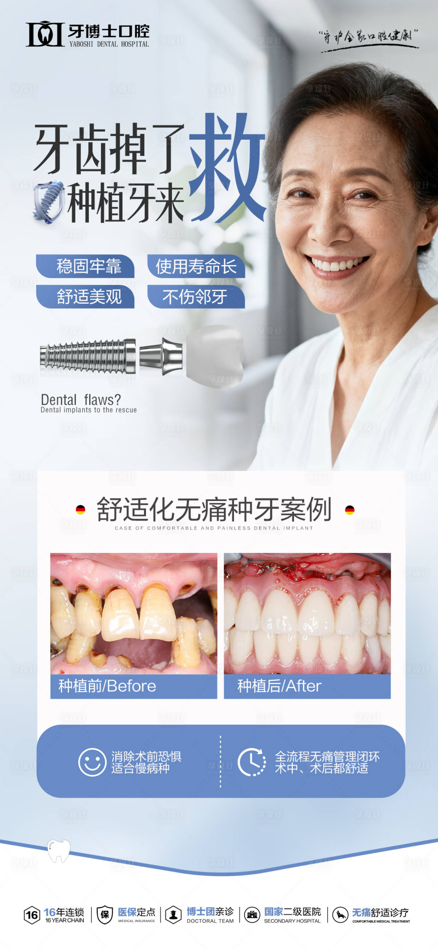 源文件下载【享设计】搜索编号：40550033863943092【种植牙案例海报】